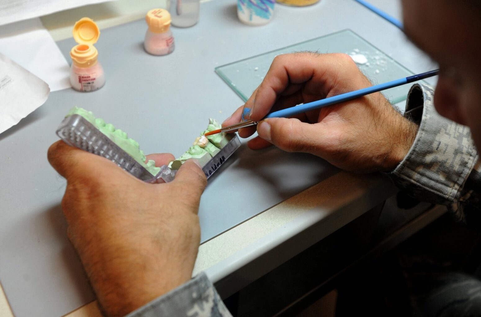 Diş laboratuvarında tam çene protez dişlerinin renklendirilmesi, All-on-4 kalıcı protez